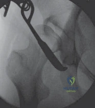 ABOS Part I & AAOS OITE Orthopedic Review: Deformity Correction, Paley's Laws & FAN | Part 21913
