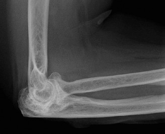 Illustration 52 for Solve Shoulder & Elbow Cases: When a Patient Presents to Clinic