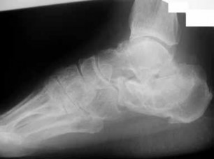 The target keyword was failed to provide. Please provide the target keyword so I can accurately rewrite the page title according to Rule 1.