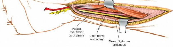 Illustration 95 for Essential Surgical Approaches: Uncover Every Aspect of the Wrist
