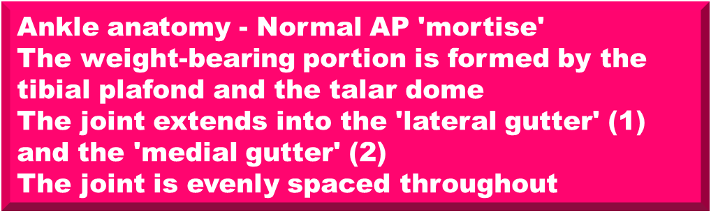 Medial Malleolus Fracture: Anatomy, Causes, and Recovery Insight