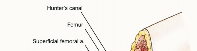 صورة طبية: استئصال نصف الحوض بالرفرفة الأمامية: حلول متقدمة لأورام الحوض الصعبة مع الأستاذ الدكتور محمد هطيف في صنعاء