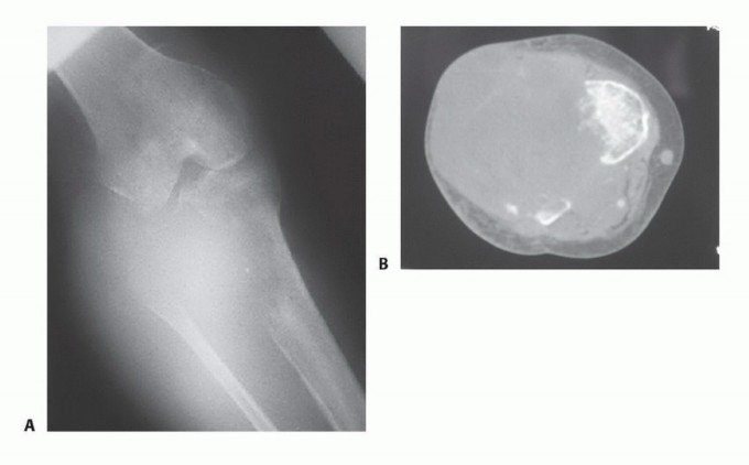 وصف طبي دقيق للمريض