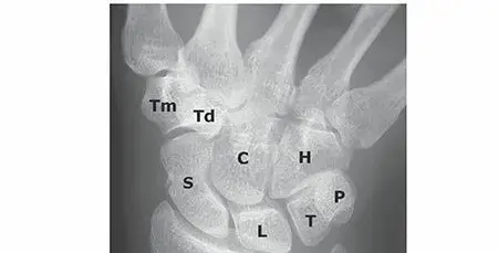 صورة توضيحية لـ إصابات الرسغ: دليل شامل للمرضى نحو التعافي الكامل مع الأستاذ الدكتور محمد هطيف