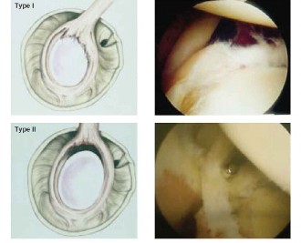 Illustration 22 for Acad Orthop Surg Challenge: Diagnose Shoulder Pain Case 1