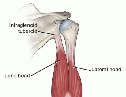 Illustration of following total elbow - Dr. Mohammed Hutaif