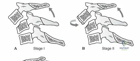 Illustration of injuries to cc - Dr. Mohammed Hutaif