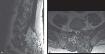 Illustration 21 for Master Orthopedic Spine Cases: Sharpen Your Diagnostic Skills