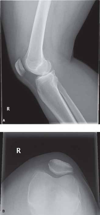 Illustration 6 for Solve Sports Medicine Cases: Uncover Why the Correct Answer Is E