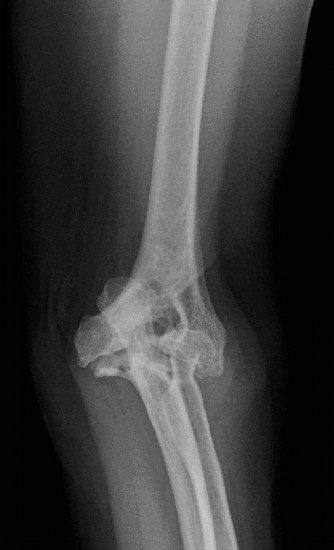 Illustration 112 for Acad Orthop Surg Challenge: Diagnose Shoulder Pain Case 1