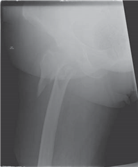 Illustration 12 for Ace Your FRCS: Key Questions in Trauma & Orthopaedics