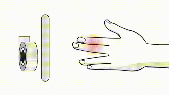 Complex Regional Pain Syndrome MAKING A DIAGNOSIS