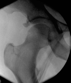 Lower Limb Trauma: Master Urgent Management & Ace Your Exams