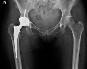 Illustration 3 for Structured Hip Oral Examination: Master This Complex Case