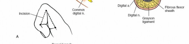 Illustration 154 for Essential Surgical Approaches: Uncover Every Aspect of the Wrist