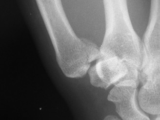 Illustration 11 for Orthopedic Hand Cases: A Patient's Journey, Is a Year Old a Factor?