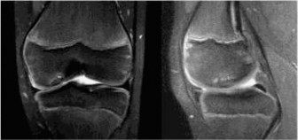 Illustration 2 for 14 Pediatrics Cases: What's Your Next Step in Management?