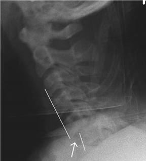 Illustration 14 for Ace Your FRCS: Key Questions in Trauma & Orthopaedics