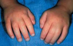 Illustration of digits of differing - Dr. Mohammed Hutaif