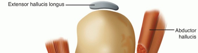 Mastering Arthrodesis of the First MTP Joint: Key Insights