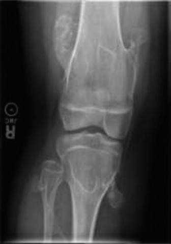 What to Monitor: Risks & Deformities for Patients with MHE