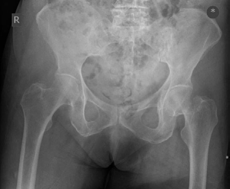 Illustration 2 for Ace Your Ortho Exam: Lower Limb Trauma Structured Oral Examination Question