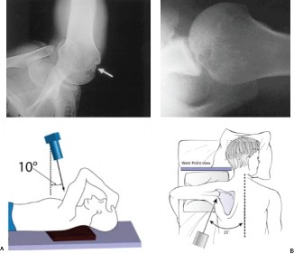 Illustration 46 for Acad Orthop Surg Challenge: Diagnose Shoulder Pain Case 1