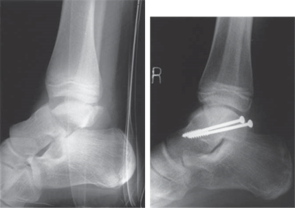 Illustration 2 for Ace Your FRCS: Key Questions in Trauma & Orthopaedics