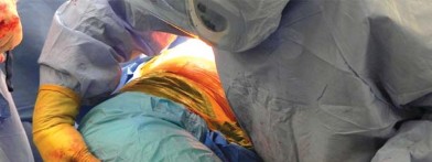 صورة طبية: تقنية الجذع القصير لاستبدال مفصل الورك الكلي: نهج الأستاذ الدكتور محمد هطيف لتدخل جراحي أقل ونتائج أفضل