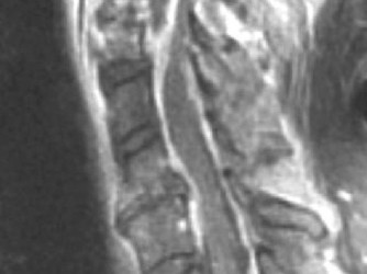 Illustration 12 for Master Orthopedic Spine Cases: Sharpen Your Diagnostic Skills