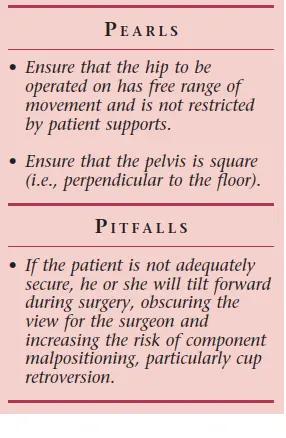 صورة توضيحية لـ النهج الخلفي لمفصل الورك: دليل شامل لاستعادة الحركة في صنعاء مع الأستاذ الدكتور محمد هطيف