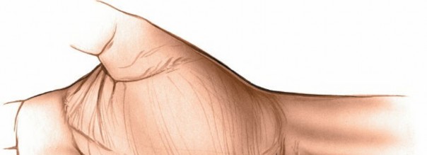 Effective Volar Approach to the Ulnar Nerve: Decompression & Exploration