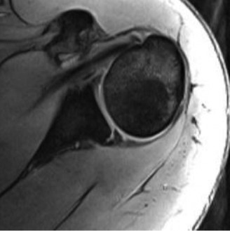 Illustration 42 for Acad Orthop Surg Challenge: Diagnose Shoulder Pain Case 1