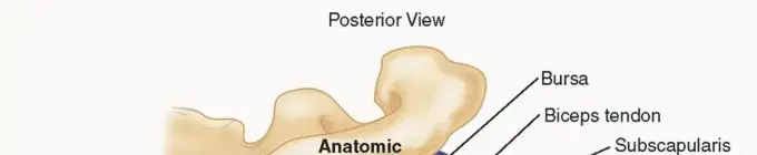 جراحة تطعيم العظام للكتف: حل فعال لحالات عدم الاستقرار مع فقدان العظم