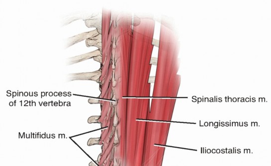 Optimizing Pedicle Screw Placement for MIS TLIF Success