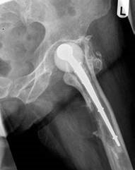 Illustration 3 for Structured Hip Oral: Master This Exam Question & Case