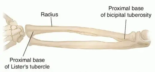 صورة توضيحية لـ كسور عظام الساعد: دليل شامل للمرضى بقلم الأستاذ الدكتور محمد هطيف