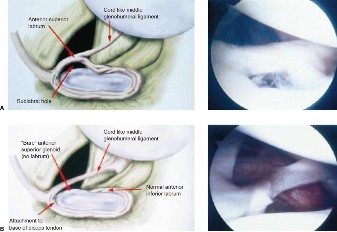 Illustration 24 for Acad Orthop Surg Challenge: Diagnose Shoulder Pain Case 1