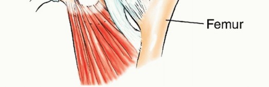توضيح طبي: جراحة نقائل الحوض: حل شامل لآلام العظام واستعادة الحركة مع الأستاذ الدكتور محمد هطيف