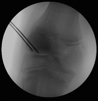 Illustration 3 for 14 Pediatrics Cases: What's Your Next Step in Management?