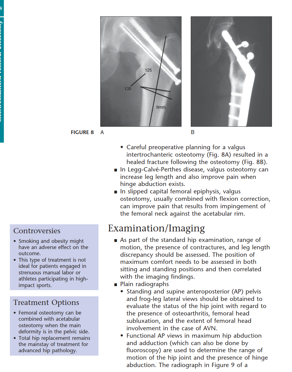 Illustration 5 for Intertrochanteric Femoral Osteotomy: Indications for Hip Preservation