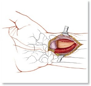 Illustration of aspect of the wrist - Dr. Mohammed Hutaif