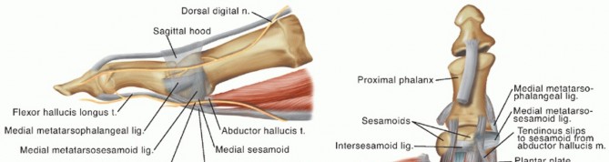Sesamoidectomy: Your Guide to Hallux MTP Joint Pain Relief