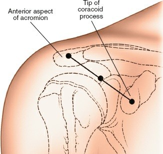 Illustration 217 for Essential Guide: Mastering Every Approach to the Shoulder