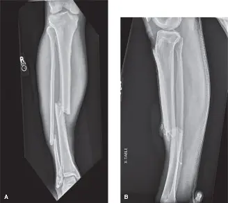 صورة توضيحية لـ متلازمة الحيز الحادة بعد الإصابات: دليل شامل للمرضى مع الأستاذ الدكتور محمد هطيف