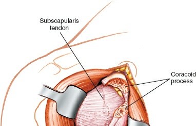 Illustration 22 for Essential Guide: Mastering Every Approach to the Shoulder