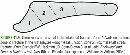 Illustration 24 for Mastering First MTP Joint & Forefoot Fractures: A Comprehensive Guide
