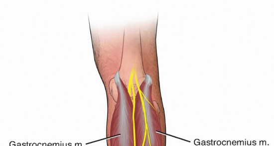 Restore Ankle Mobility: Lengthening the Gastrocnemius and Soleus