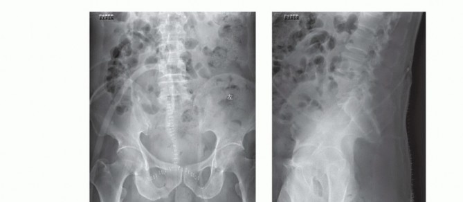 صورة طبية: جراحة أورام العجز: الحفاظ على وظائف الأمعاء والمثانة مع الأستاذ الدكتور محمد هطيف في صنعاء