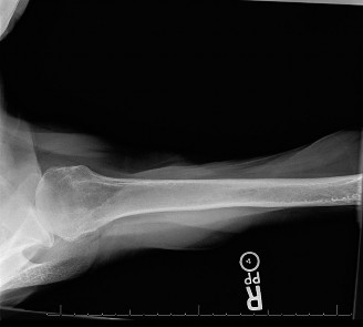 Illustration 52 for Acad Orthop Surg Challenge: Diagnose Shoulder Pain Case 1